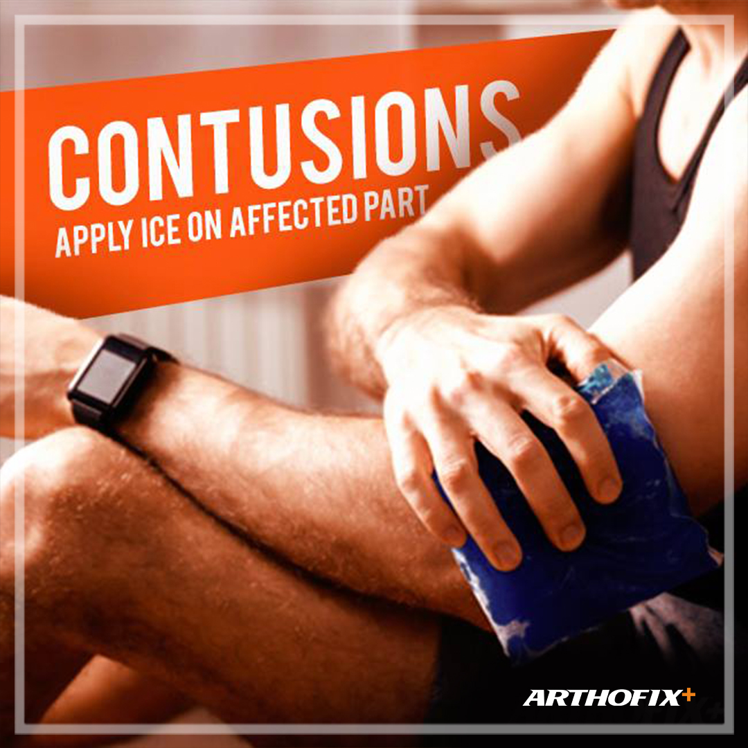 Close-up of a person applying an Arthox Fix ice pack to their elbow for contusion treatment, with advice text in the background.